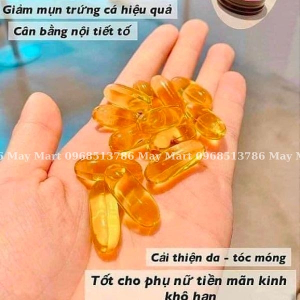 Thực phẩm chức năng Tinh dầu hoa anh thảo Hàn Quốc Gamma Linolenic Acid 300