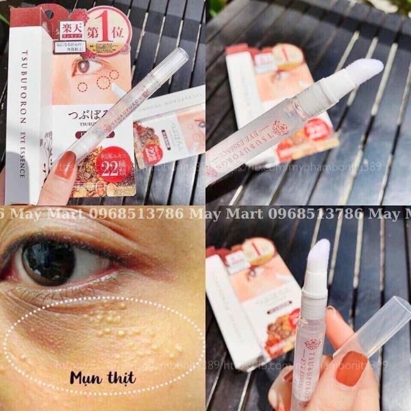 Kem trị mụn thịt Tsubuporon Eye Essence Nhật Bản