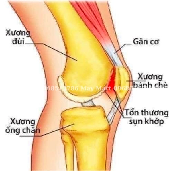 SỤN CÁ MẬP COSTAR SHARK CARTILAGE, ÚC - NHẬP KHẨU
